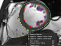 Circle Cardiovascular Imaging CVI42官方最新版v5.1.1